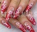 STELLA NAILS - НОКТОПЛАСТИКА